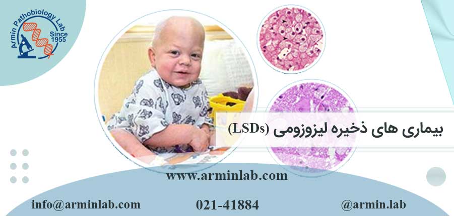 بیماری های ذخیره لیزوزومی (LSDs)