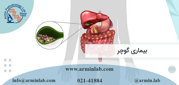 بیماری گوچر