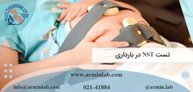تست-NST-در-بارداری-arminlab تست NST در بارداری