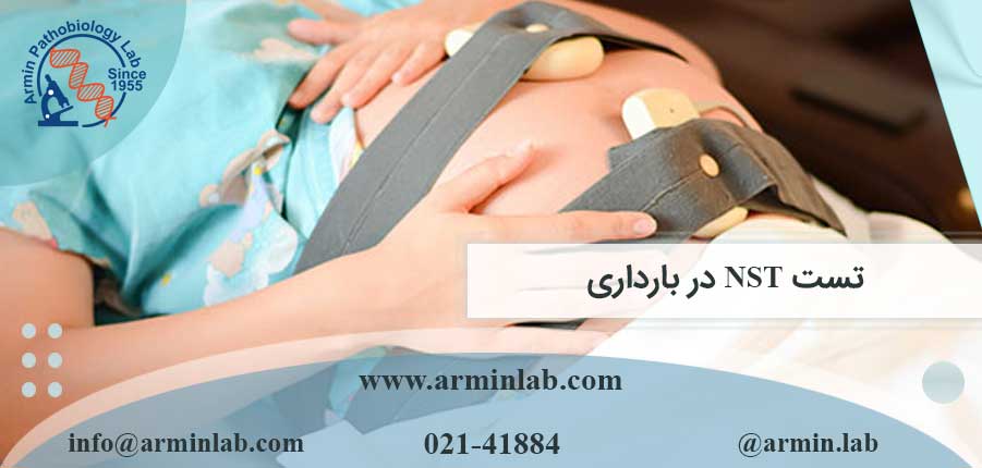تست NST در بارداری
