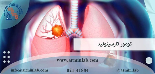 تومور-کارسینوئید-arminlab تومور کارسینوئید