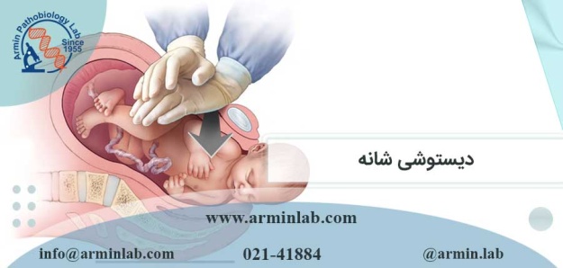 دیستوشی شانه چیست؟