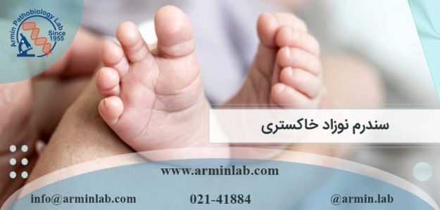 سندرم نوزاد خاکستری