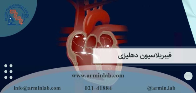 فیبریلاسیون دهلیزی