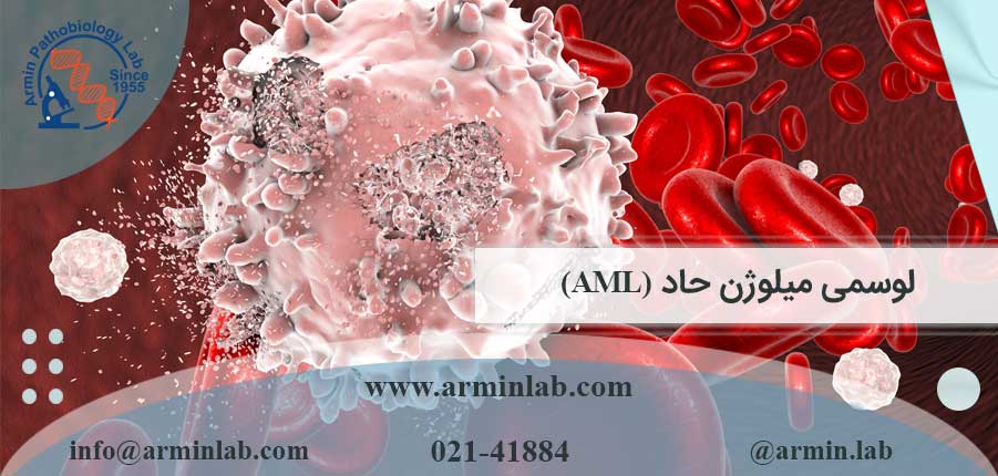 لوسمی میلوژن حاد (AML)