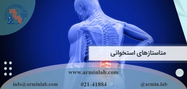 متاستازهای استخوانی