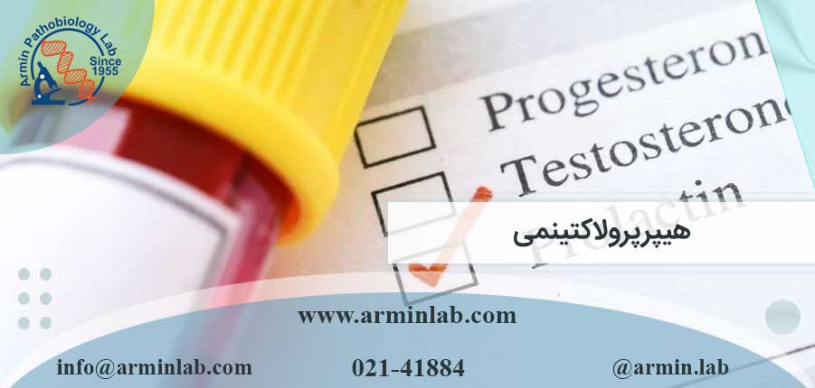 هیپرپرولاکتینمی