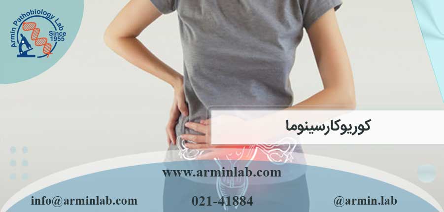 کوریوکارسینوما-arminlab کوریوکارسینوما