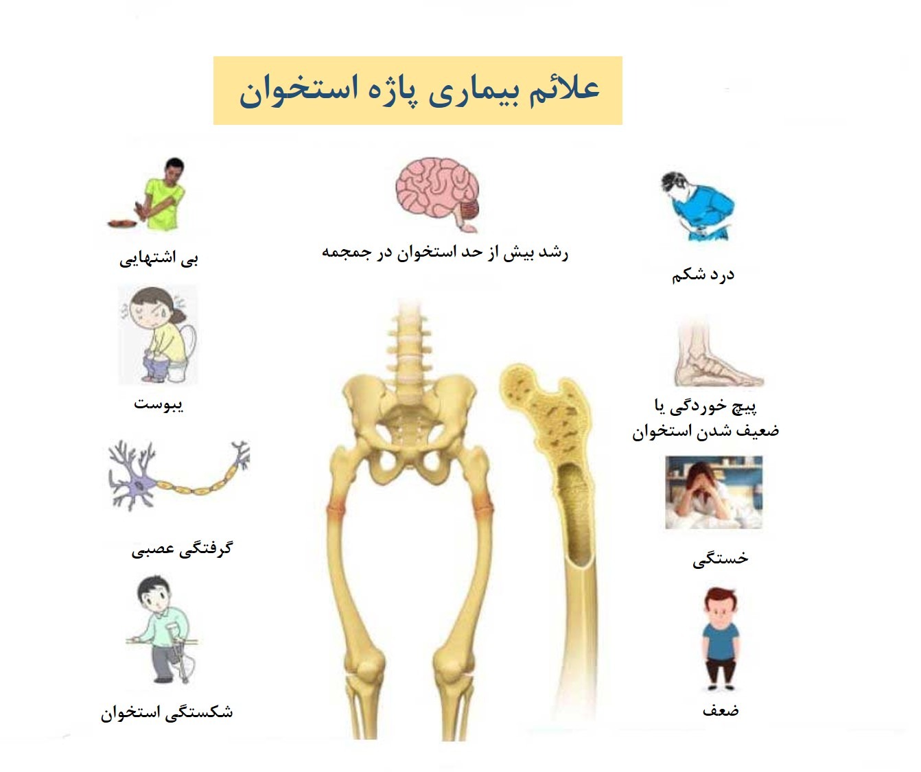 بیماری پاژه استخوان