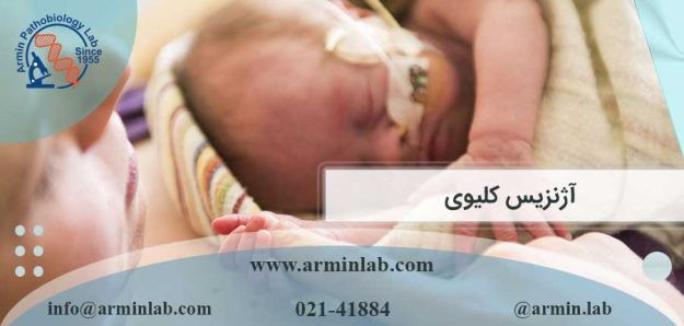 آژنزیس کلیوی