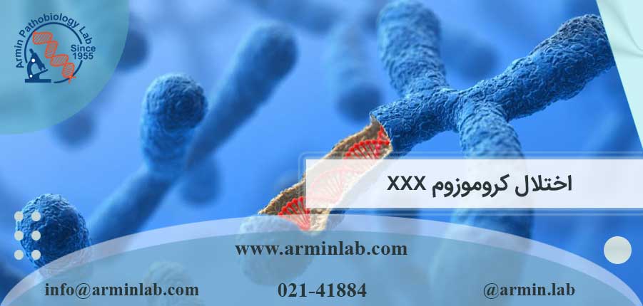 اختلال کروموزوم XXX