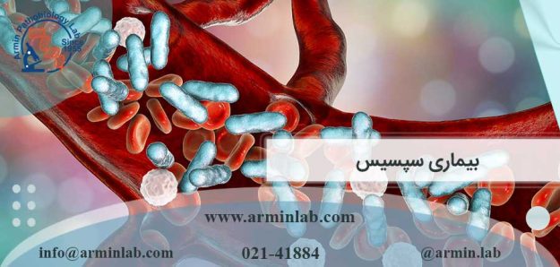 بیماری سپسیس