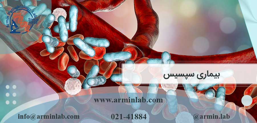 بیماری سپسیس
