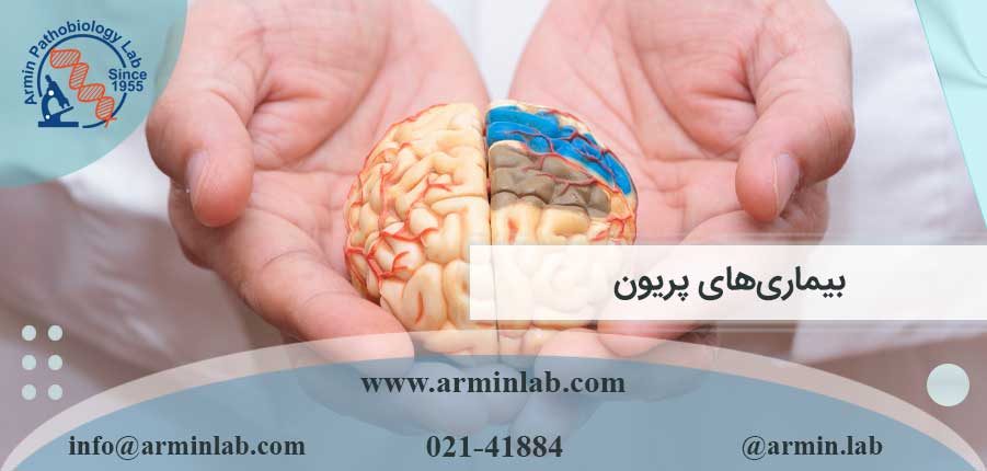 بیماری های پریون