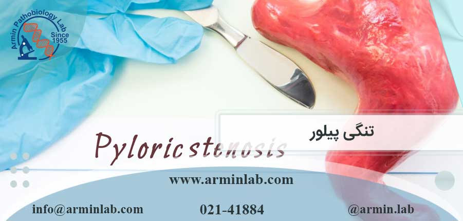 تنگی پیلور (HPS)