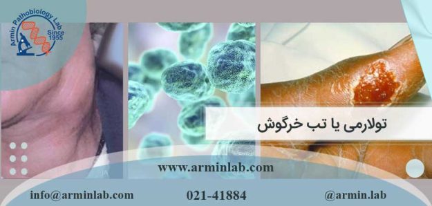 تولارمی یا تب خرگوش