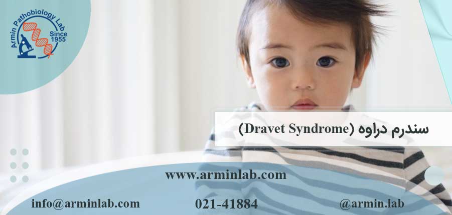 سندرم دراوه (Dravet Syndrome)