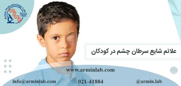 علائم شایع سرطان چشم در کودکان