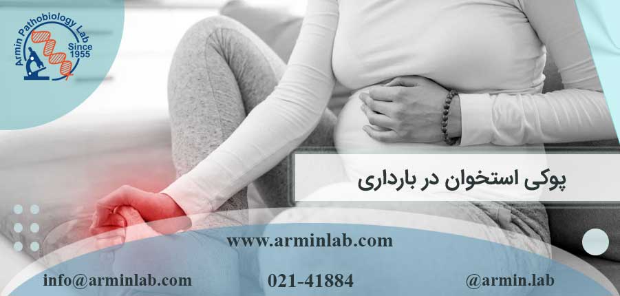 پوکی استخوان در بارداری