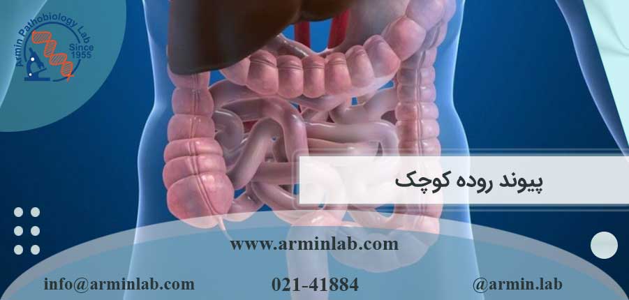 پیوند روده کوچک