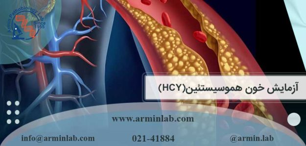 آزمایش خون هموسیستئین