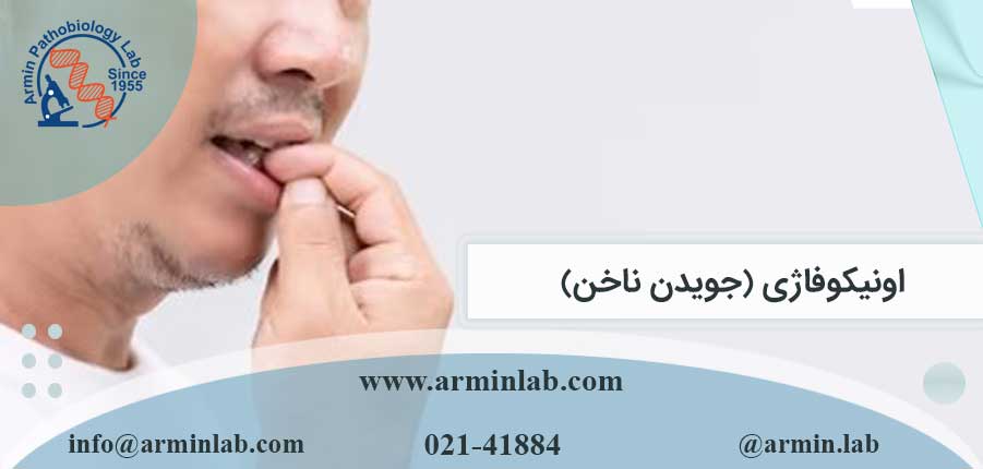 اونیکوفاژی (جویدن ناخن)