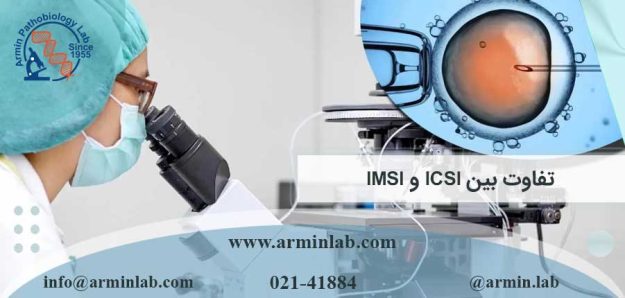 تفاوت بین ICSI و IMSI