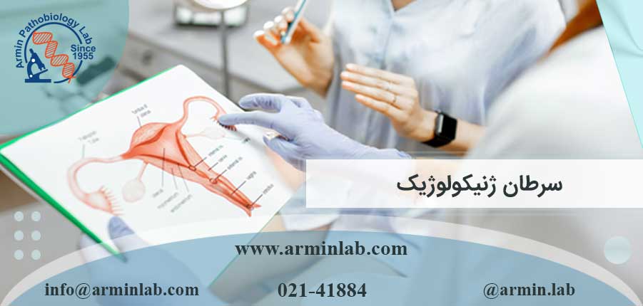 سرطان ژنیکولوژیک