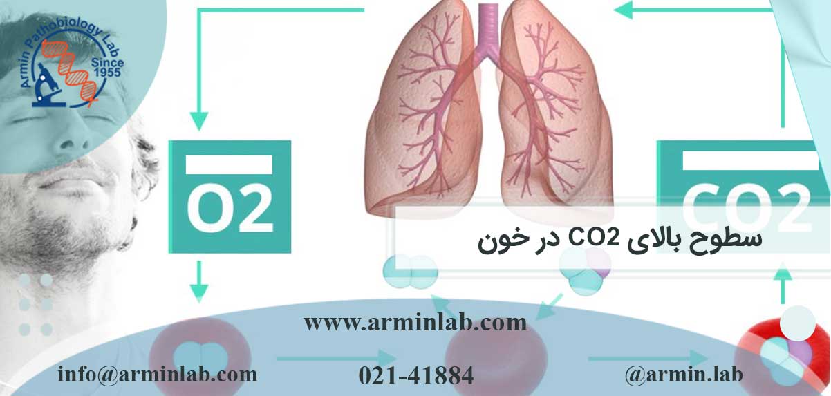 سطوح بالای CO2 در خون