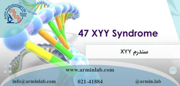 سندرم XYY