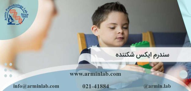 سندرم ایکس شکننده