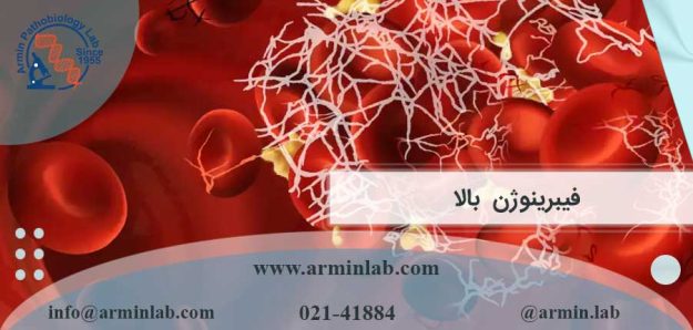 فیبرینوژن بالا