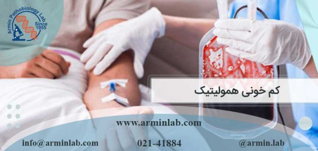 کم خونی همولیتیک