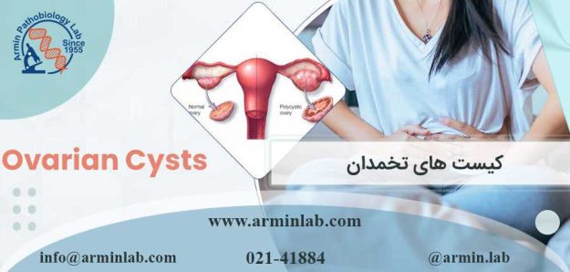 کیست های تخمدان