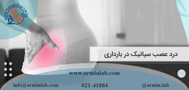 درد عصب سیاتیک در بارداری