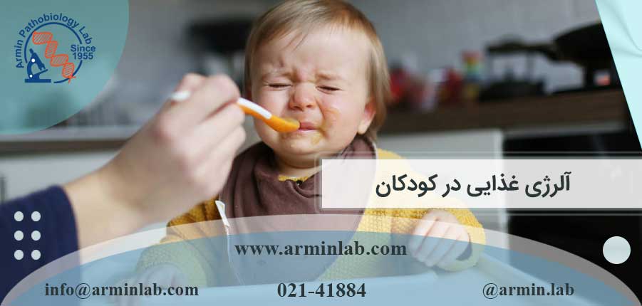 آلرژی غذایی درکودکان