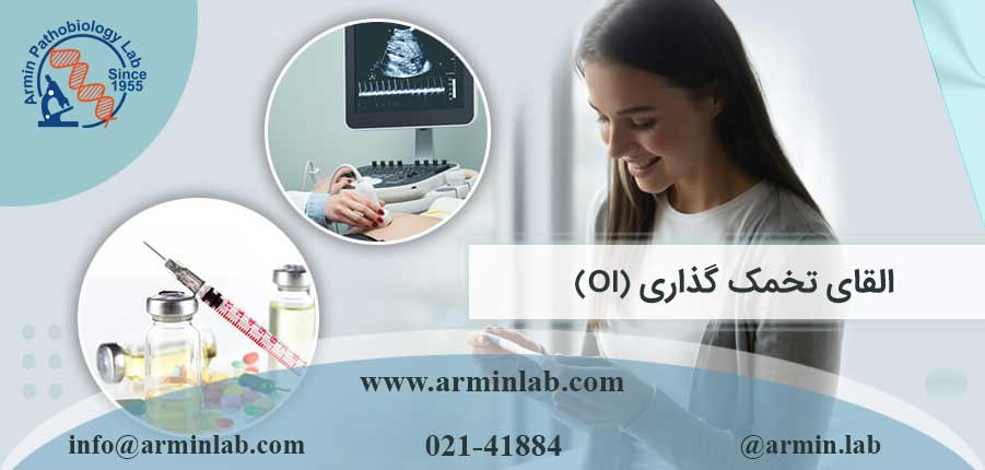 القای تخمک گذاری