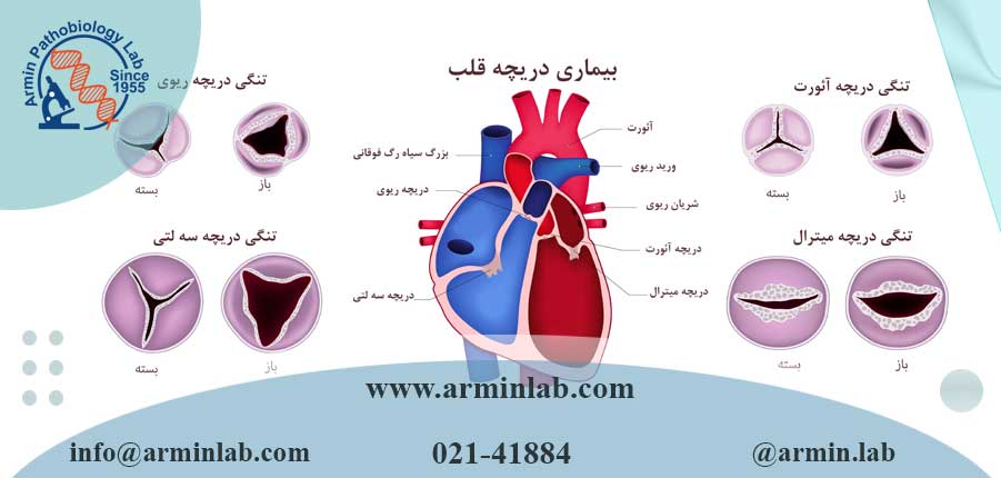 بیماری دریچه قلب در سالمندان