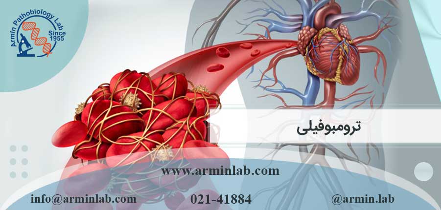 ترومبوفیلی