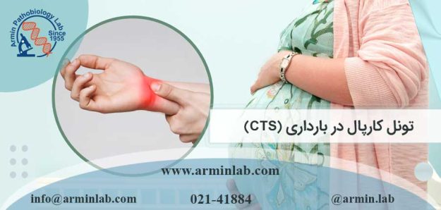 تونل کارپال در بارداری (CTS)