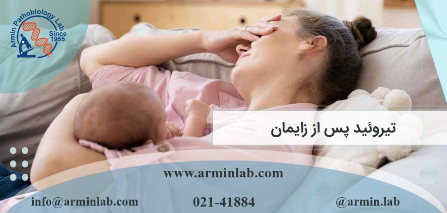 تیروئید پس از زایمان