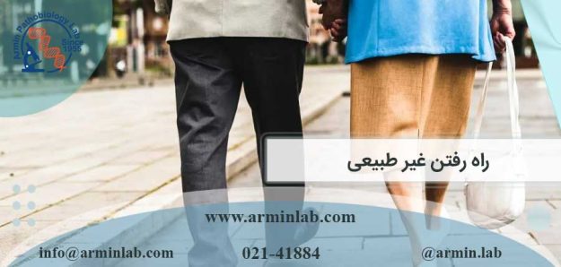 راه رفتن غیر طبیعی