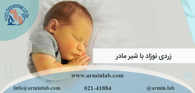 زردی نوزاد با شیر مادر