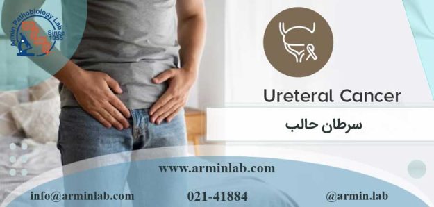 سرطان حالب