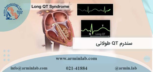 سندرم QT طولانی