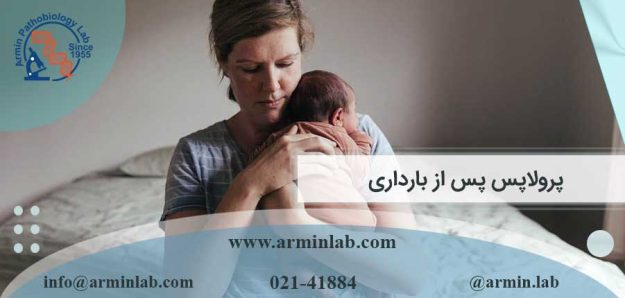 پرولاپس پس از بارداری