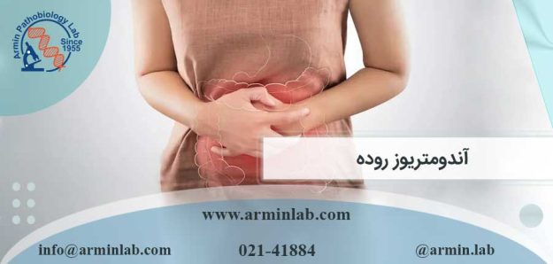آندومتریوز روده