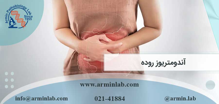 آندومتریوز روده