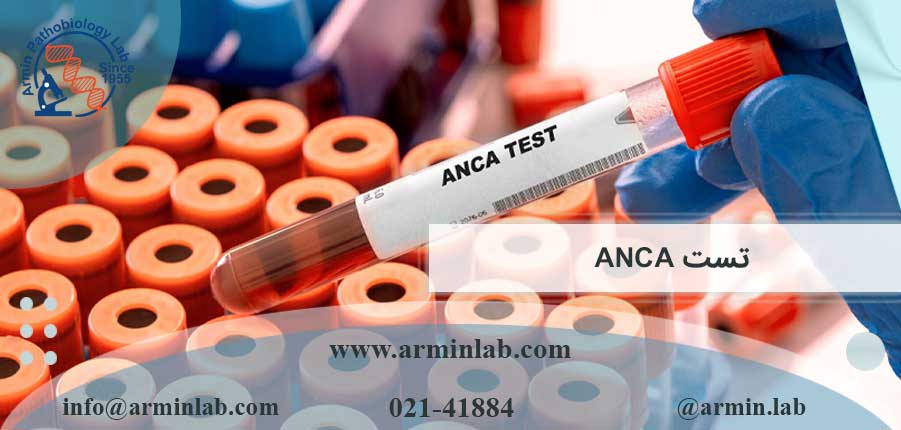 تست ANCA