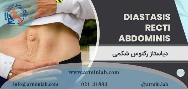 دیاستاز رکتوس شکمی